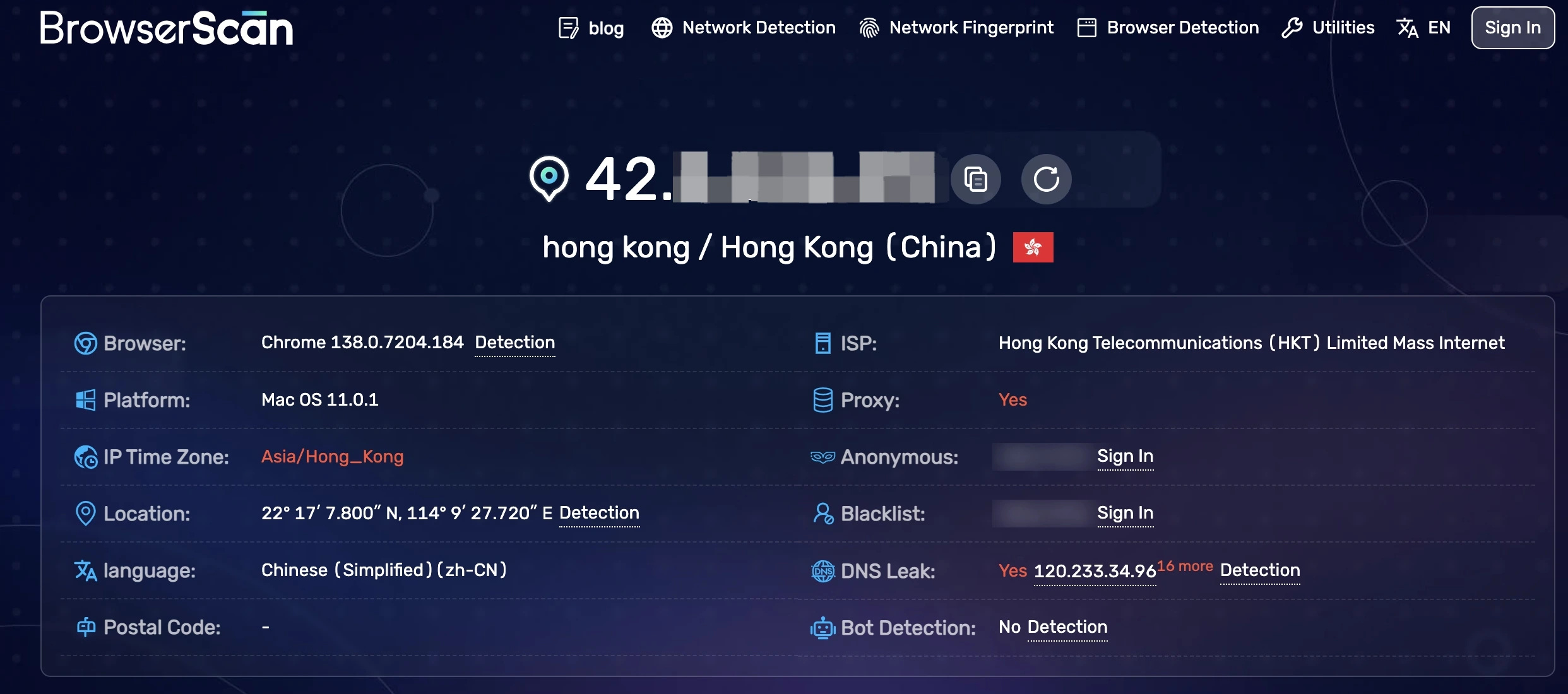 Detect IP Address